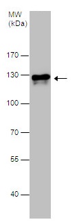 Western blot - Anti-E Cadherin (phospho S838 + S840) antibody (AB226779)