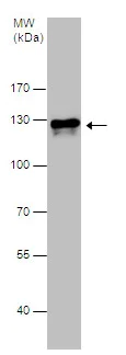Western blot - Anti-E Cadherin (phospho S838 + S840) antibody (AB226779)