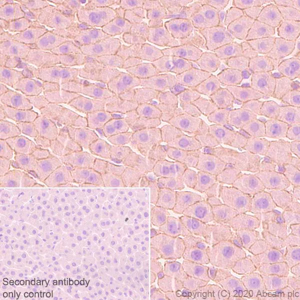 Immunohistochemistry (Formalin/PFA-fixed paraffin-embedded sections) - Anti-E Cadherin (phospho S838 + S840) antibody [EP913(2)Y] (AB76319)