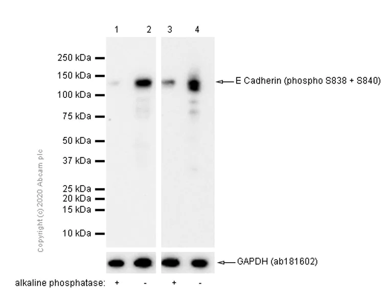 Western blot - Anti-E Cadherin (phospho S838 + S840) antibody [EP913(2)Y] (AB76319)