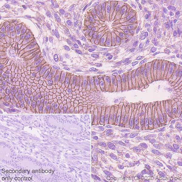 Immunohistochemistry (Formalin/PFA-fixed paraffin-embedded sections) - Anti-E Cadherin (phospho S838 + S840) antibody [EP913(2)Y] - BSA and Azide free (AB239883)