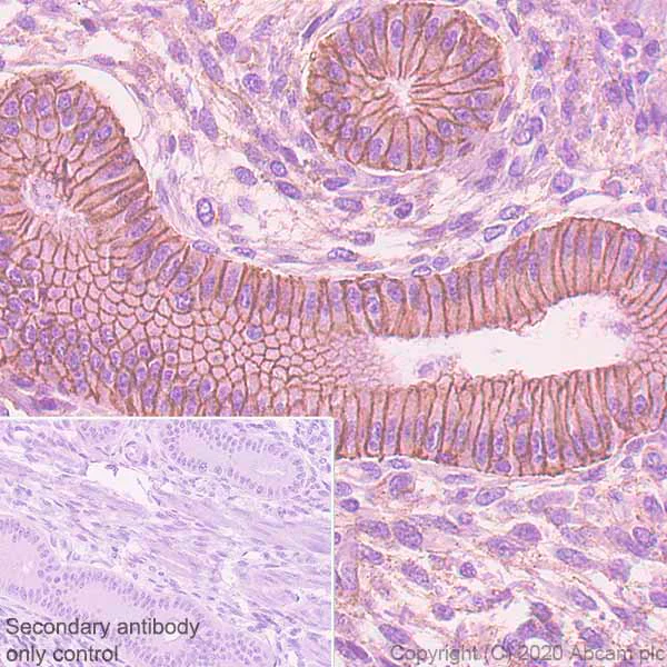 Immunohistochemistry (Formalin/PFA-fixed paraffin-embedded sections) - Anti-E Cadherin (phospho S838 + S840) antibody [EP913(2)Y] - BSA and Azide free (AB239883)