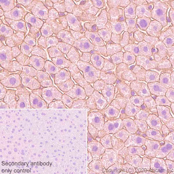 Immunohistochemistry (Formalin/PFA-fixed paraffin-embedded sections) - Anti-E Cadherin (phospho S838 + S840) antibody [EP913(2)Y] - BSA and Azide free (AB239883)