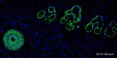 Immunohistochemistry (Formalin/PFA-fixed paraffin-embedded sections) - Anti-E Cadherin (phospho S838 + S840) antibody [EP913(2)Y] - BSA and Azide free (AB239883)