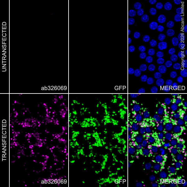 Immunocytochemistry/ Immunofluorescence - Anti-E. coli antibody [EPR28234-47] (AB326069)