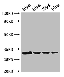 Western blot - Anti-E. coli ethanolamine ammonia lyase light chain antibody (AB193642)