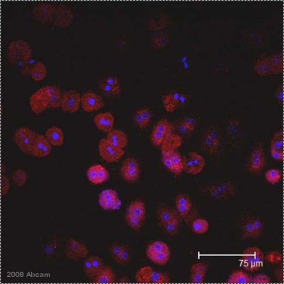 Immunocytochemistry/ Immunofluorescence - Anti-E. coli J5 LPS antibody [2D7/1] (AB35654)