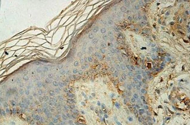 Immunohistochemistry (Formalin/PFA-fixed paraffin-embedded sections) - Anti-e-LOX-3 antibody (AB118470)
