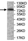 Western blot - Anti-e-LOX-3 antibody (AB118470)