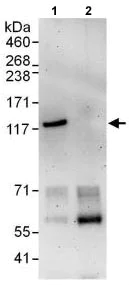 Immunoprecipitation - Anti-E-Syt1 antibody (AB118805)