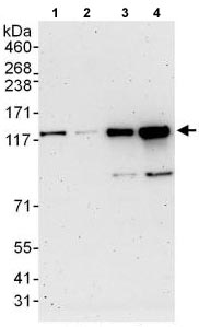 Western blot - Anti-E-Syt1 antibody (AB118805)