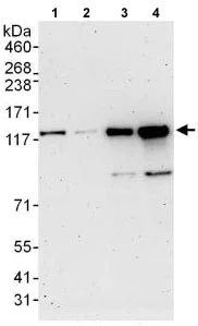 Western blot - Anti-E-Syt1 antibody (AB118805)
