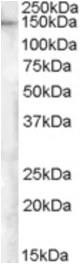 Western blot - Anti-E-Syt1 antibody (AB189199)