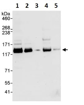 Western blot - Anti-E1 Ubiquitin Activating Enzyme 1/UBA1 antibody (AB264179)