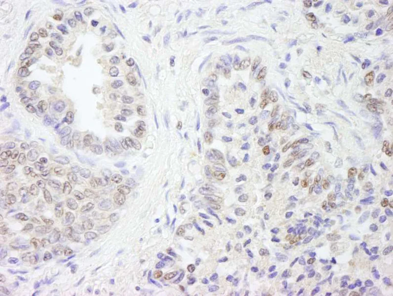 Immunohistochemistry (Formalin/PFA-fixed paraffin-embedded sections) - Anti-E1 Ubiquitin Activating Enzyme 1/UBA1 antibody (AB264182)