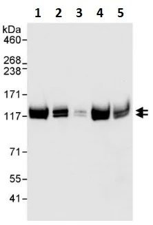 Western blot - Anti-E1 Ubiquitin Activating Enzyme 1/UBA1 antibody (AB264182)