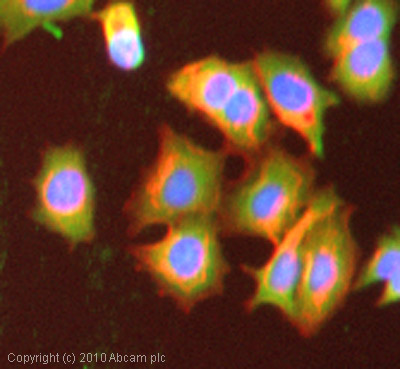 Immunocytochemistry/ Immunofluorescence - Anti-E1 Ubiquitin Activating Enzyme 1/UBA1 antibody (AB34711), expandable thumbnail