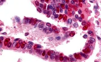 Immunohistochemistry (Formalin/PFA-fixed paraffin-embedded sections) - Anti-E1 Ubiquitin Activating Enzyme 1/UBA1 antibody (AB34711)