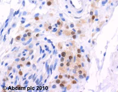 Immunohistochemistry (Formalin/PFA-fixed paraffin-embedded sections) - Anti-E1 Ubiquitin Activating Enzyme 1/UBA1 antibody (AB34711)