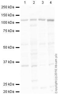 Western blot - Anti-E1 Ubiquitin Activating Enzyme 1/UBA1 antibody (AB34711), expandable thumbnail