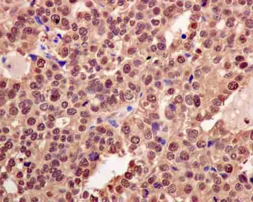 Immunohistochemistry (Formalin/PFA-fixed paraffin-embedded sections) - Anti-E1 Ubiquitin Activating Enzyme 1/UBA1 antibody [EPR14203(B)] (AB180125)