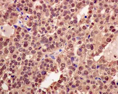 Immunohistochemistry (Formalin/PFA-fixed paraffin-embedded sections) - Anti-E1 Ubiquitin Activating Enzyme 1/UBA1 antibody [EPR14203(B)] - BSA and Azide free (AB250138), expandable thumbnail