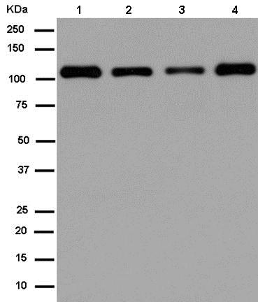 Western blot - Anti-E1 Ubiquitin Activating Enzyme 1/UBA1 antibody [EPR14203(B)] - BSA and Azide free (AB250138), expandable thumbnail