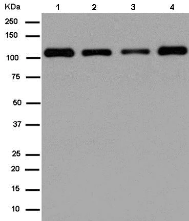Western blot - Anti-E1 Ubiquitin Activating Enzyme 1/UBA1 antibody [EPR14203(B)] - BSA and Azide free (AB250138)