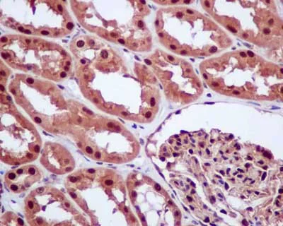 Immunohistochemistry (Formalin/PFA-fixed paraffin-embedded sections) - Anti-E1 Ubiquitin Activating Enzyme 1/UBA1 antibody [EPR14204(B)] (AB181225)