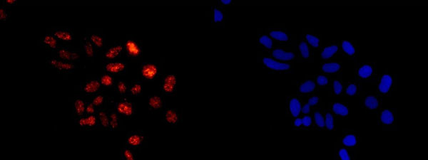 Immunocytochemistry/ Immunofluorescence - Anti-E1 Ubiquitin Activating Enzyme 1/UBA1 antibody [EPR14204(B)] - BSA and Azide free (AB250441), expandable thumbnail