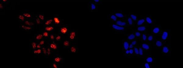Immunocytochemistry/ Immunofluorescence - Anti-E1 Ubiquitin Activating Enzyme 1/UBA1 antibody [EPR14204(B)] - BSA and Azide free (AB250441)