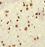 Immunohistochemistry (Formalin/PFA-fixed paraffin-embedded sections) - Anti-E1B-AP5 antibody [EP2633Y] (AB68480)