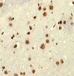 Immunohistochemistry (Formalin/PFA-fixed paraffin-embedded sections) - Anti-E1B-AP5 antibody [EP2633Y] - BSA and Azide free (AB284715)