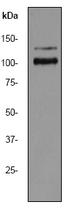 Western blot - Anti-E1B-AP5 antibody [EP2633Y] - BSA and Azide free (AB284715)
