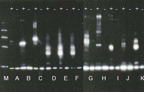 Functional Studies - E2-Ubiquitin Conjugation Kit (AB139472)