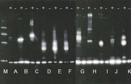 Functional Studies - E2-Ubiquitin Conjugation Kit (AB139472)