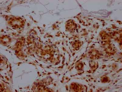 Immunohistochemistry (Formalin/PFA-fixed paraffin-embedded sections) - Anti-E2F1 antibody [1D12] (AB288369)
