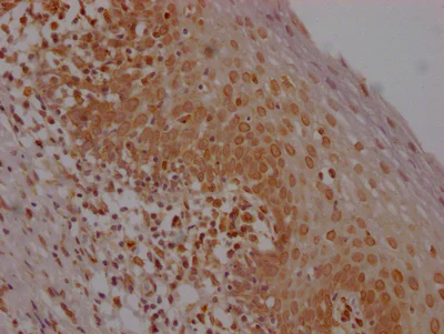 Immunohistochemistry (Formalin/PFA-fixed paraffin-embedded sections) - Anti-E2F1 antibody [1D12] (AB288369)