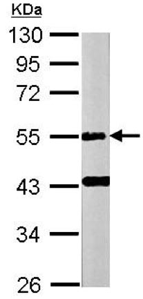 Western blot - Anti-E2F1 antibody (AB137415), expandable thumbnail