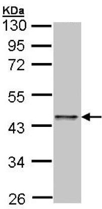 Western blot - Anti-E2F1 antibody (AB137415), expandable thumbnail