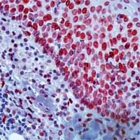 Immunohistochemistry (Formalin/PFA-fixed paraffin-embedded sections) - Anti-E2F1 antibody [KH95] (AB4070)