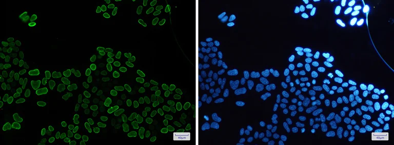 Immunocytochemistry/ Immunofluorescence - Anti-E2F1 Antibody [S03-5G3] (AB317385)