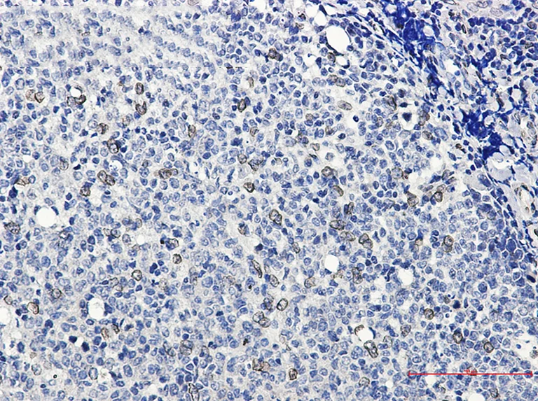 Immunohistochemistry (Formalin/PFA-fixed paraffin-embedded sections) - Anti-E2F1 Antibody [S03-5G3] (AB317385)