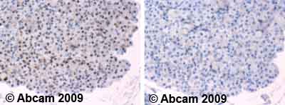 Immunohistochemistry (Formalin/PFA-fixed paraffin-embedded sections) - Anti-E2F1 (phospho T433) antibody (AB55325), expandable thumbnail