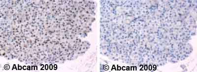 Immunohistochemistry (Formalin/PFA-fixed paraffin-embedded sections) - Anti-E2F1 (phospho T433) antibody (AB55325)