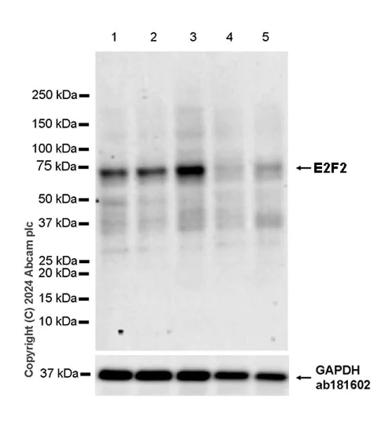 Western blot - Anti-E2F2 antibody [EPR27391-170] - BSA and Azide free (AB318957)