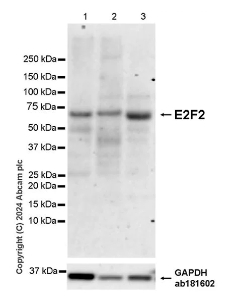 Western blot - Anti-E2F2 antibody [EPR27391-170] - BSA and Azide free (AB318957)