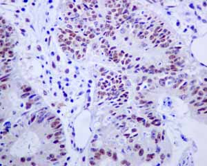 Immunohistochemistry (Formalin/PFA-fixed paraffin-embedded sections) - Anti-E2F4 antibody [EPR8259] (AB150360)