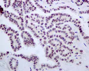 Immunohistochemistry (Formalin/PFA-fixed paraffin-embedded sections) - Anti-E2F4 antibody [EPR8259] - BSA and Azide free (AB240118), expandable thumbnail