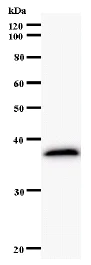 Western blot - Anti-E2F5 antibody [220D1a] (AB59769)